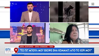 Θύμα επίθεσης: Το πιτ μπουλ μου έκοψε ένα κομμάτι από το χέρι μου | Επί τόπου 02/06/2024 | OPEN TV