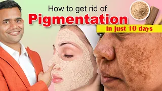 How To Get Rid Of Pigmentation, Melasma | Homemade Face Mask For Flawless Glowing Skin