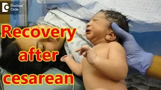 Recovery after Cesarean delivery -Dr.Bhupinder Singh Duggal of Cloudnine Hospitals | Doctors' Circle