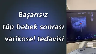 Başarısız Tüp Bebek Sonrası #varikosel  Tedavisi -  Doç Dr. Muhsin Balaban