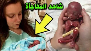 أنجبت زوجته طفلاً أسود فتركها وبعد 3 سنوات كشف الحمض النووي عن شئ  لا يمكن تصوره ؟ شاهد المفاجأة