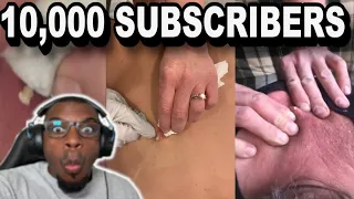 Popping Extravaganza: Celebrating 10,000+ Subs with the Best Pimple Pops