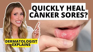 Dermatologist Explains Canker Sores: How to Prevent & Heal Them Faster | Dr. Sam Ellis