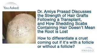 Why Dislodged Scabs Containing Hair After a Hair Transplant Doesn't Mean That Hair Grafts are Lost