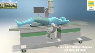 Extracorporeal Shock Wave Lithotripsy (ESWL) – CIMS Hospital