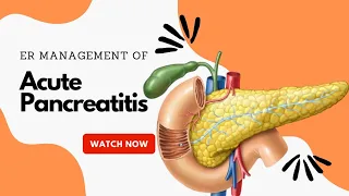 Management of Acute Pancreatitis