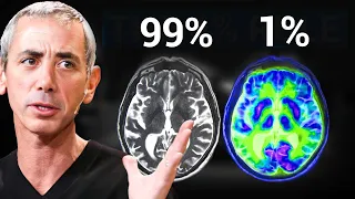 NEUROSCIENTIST: How the Top 1% Master Productivity