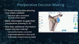 Webinar Replay: "From Planning to Placement: Verified with ExactechGPS"