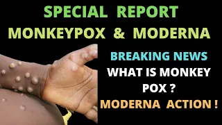 MonkeyPox Breakout News | Moderna Stock Analysis | Unusual Activity & What Is MonkeyPOX ?