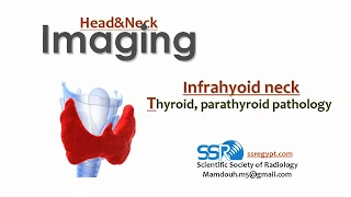 20 Thyroid and parathyroid glands Imaging - prof.Mamdouh Mahfouz (2019 edition)