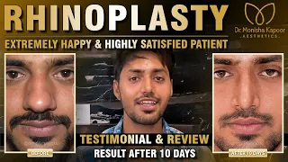 Rhinoplasty in Delhi | Extremely Happy & Highly Satisfied Patient | Testimonial & Review