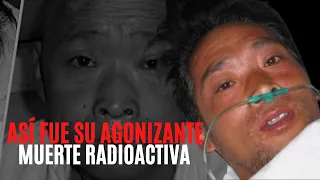 El lento y cruel final del hombre “más radioactivo” del mundo.