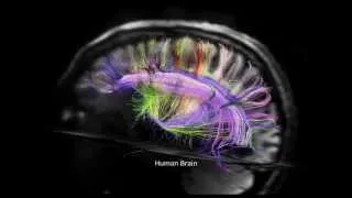 New Discoveries in Brain Structure and Connectivity