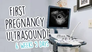 FIRST PREGNANCY ULTRASOUND! - 6 Weeks Pregnant & No Heartbeat Yet