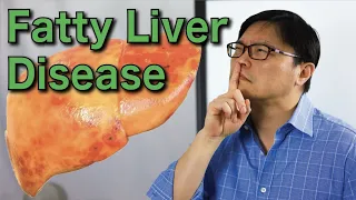 How to Reverse Fatty Liver Disease Naturally | Jason Fung