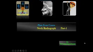 How to Read Neck X ray -Part 1