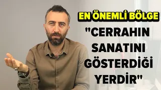 Burun Ucu Estetiği (Tipplasti) Nedir Nasıl Yapılır?