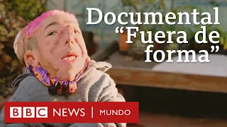 "Fuera de forma": la vida imparable de Matías Fernández Burzaco | BBC Mundo
