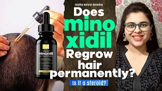 Does Minoxidil Regrow hair permanently? Minoxidil side effects. Minoxidil results. Hair fall