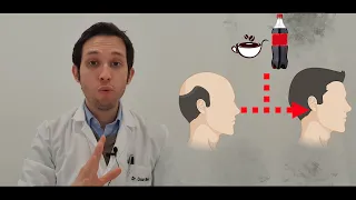 Doctor te explica si la cafeína ayuda a la calvicie