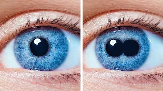 มนุษย์สามารถมีรูม่านตาสองรูในตาข้างเดียวและสิ่งแปลกๆ อื่นๆ เกี่ยวกับร่างกาย
