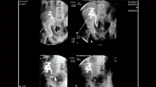 Film reading Urogenital imaging Dr Hassan El Kiki part 2