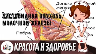 Листовидная опухоль молочной железы