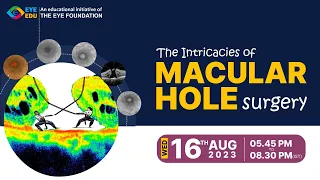The Intricacies of MACULAR HOLE surgery