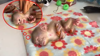 Day 2 Meet Vet, Newborn Baby Monkey Get Injection For His Weakness Health