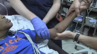 Posterior Elbow Dislocation Reduction