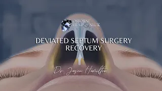 Deviated Septum Surgery and Recovery