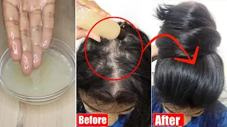 Triple Hair Growth Boosting Gel-गंजे सर में भी बाल वापिस उगाये-💯%Thick, Dense, Long Hair-No Hairfall