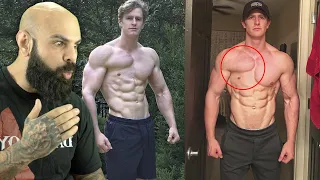 REAGINDO AO TREINO DO BODYBUILDER QUE NASCEU COM SOMENTE UM PEITORAL