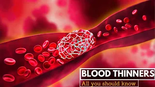 Blood Thinners, Everything You Need to Know