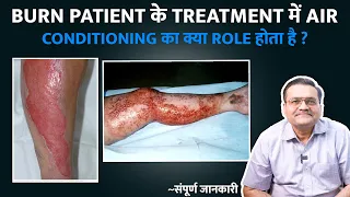 Burn Patient के Treatment में Air Conditioning का क्या Role होता है ? | जले मरीजों के इलाज में ac ?