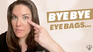 How to QUICKLY Get Rid of Your Eye BAGS For Good