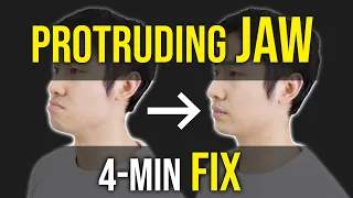 Protruding Jaw / Underbite Fix ｜Facial Asymmetry Correction｜Corrective Exercises