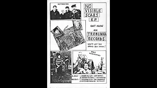 No Visible Scars EP 1985 (Punk Scotland)