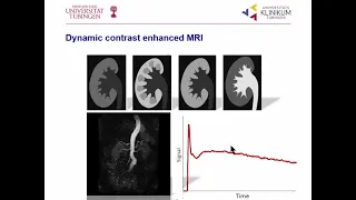 ISMRM MR Academy - Applications of Perfusion MRI in the Body