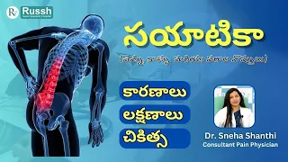 What is Sciatica? | Causes, Signs, Symptoms, Diagnosis & Treatment | Explained in Telugu #sciatica