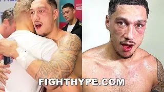 JAI OPETAIA, WITH BROKEN JAW, GETS MAD RESPECT FROM BRIEDIS & HORN; BEHIND-THE-SCENES AFTER FIGHT