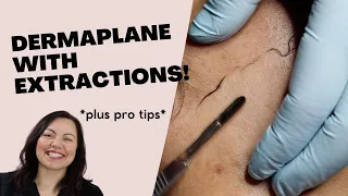 Must Watch Dermaplane! With PRO Tips!