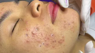 Satisfying With Loan Nguyen Spa Video #001