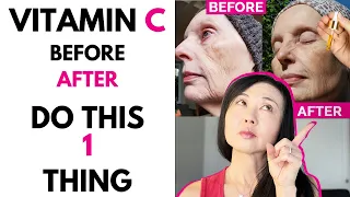 VITAMIN C BEFORE AFTER: DO THIS ONE THING #goseechristyvitaminc