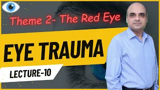 Eye Trauma Lecture 10