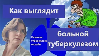 Как выглядит больной туберкулезом