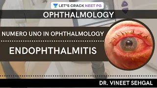 Numero Uno in Ophthalmology: Endophthalmitis  | NEET-PG 2021 | Vineet Sehgal