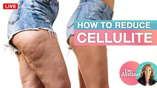 How to Reduce Cellulite | Tips, Foods, Exercise & What Works | Dr. J9 Live