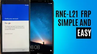 HUAWEI MATE 10 LITE (RNE-L21) FRP /GOOGLE ACCOUNT BYPASS WITHOUT PC