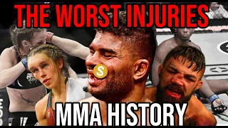 The Worst Injuries in UFC History! CUTS, Breaks and More